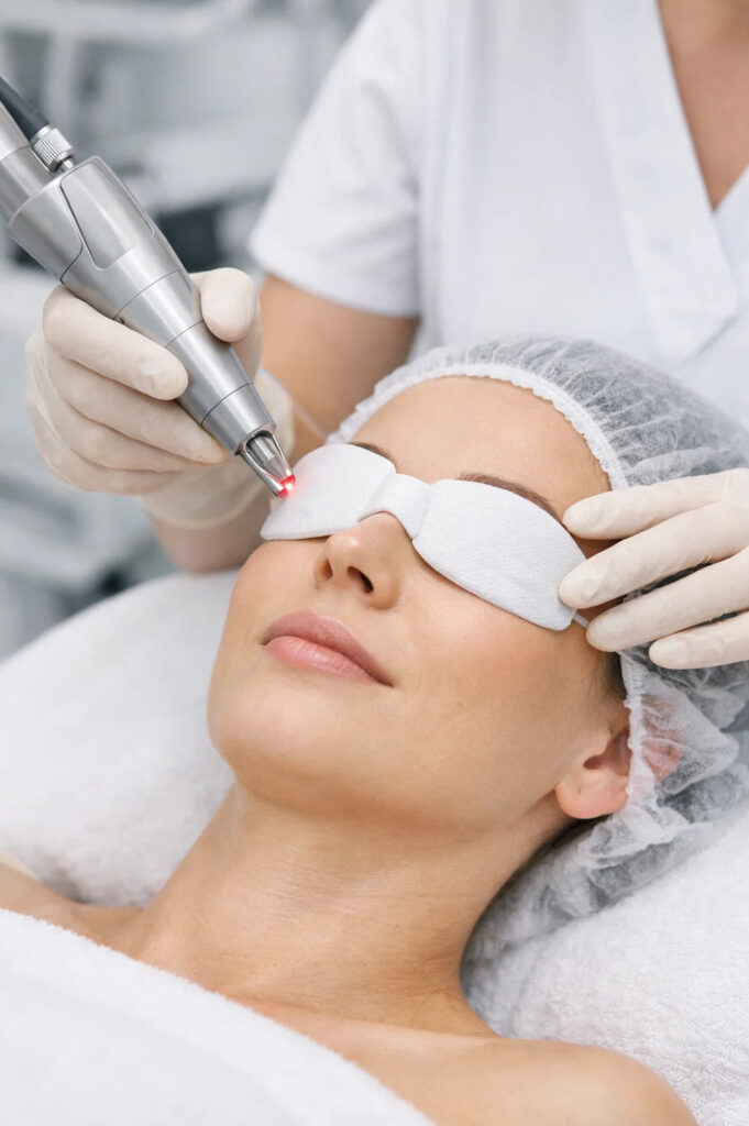 Laserowy lifting powiek