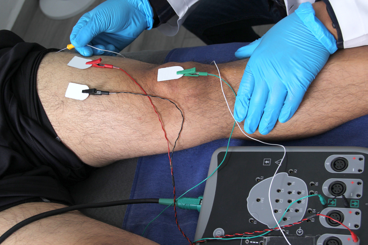 Electromyography EMG and Somatosensory Evoked Potential PEV of lower extremities, neurophysiological test applies electrical stimuli near the nerves